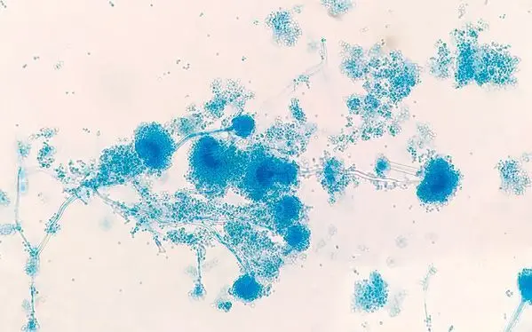 Figura 1. Aspergillus fumigatus