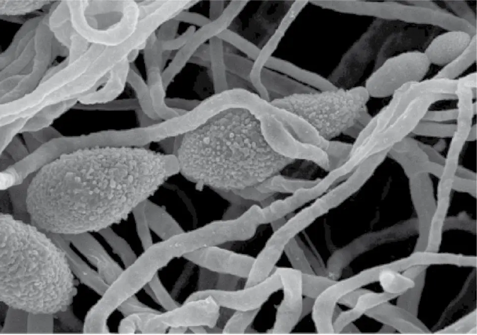 Figura 2. Esporas de Alternaria alternata. Microscopía electrónica de barrido (x 855 aumentos)