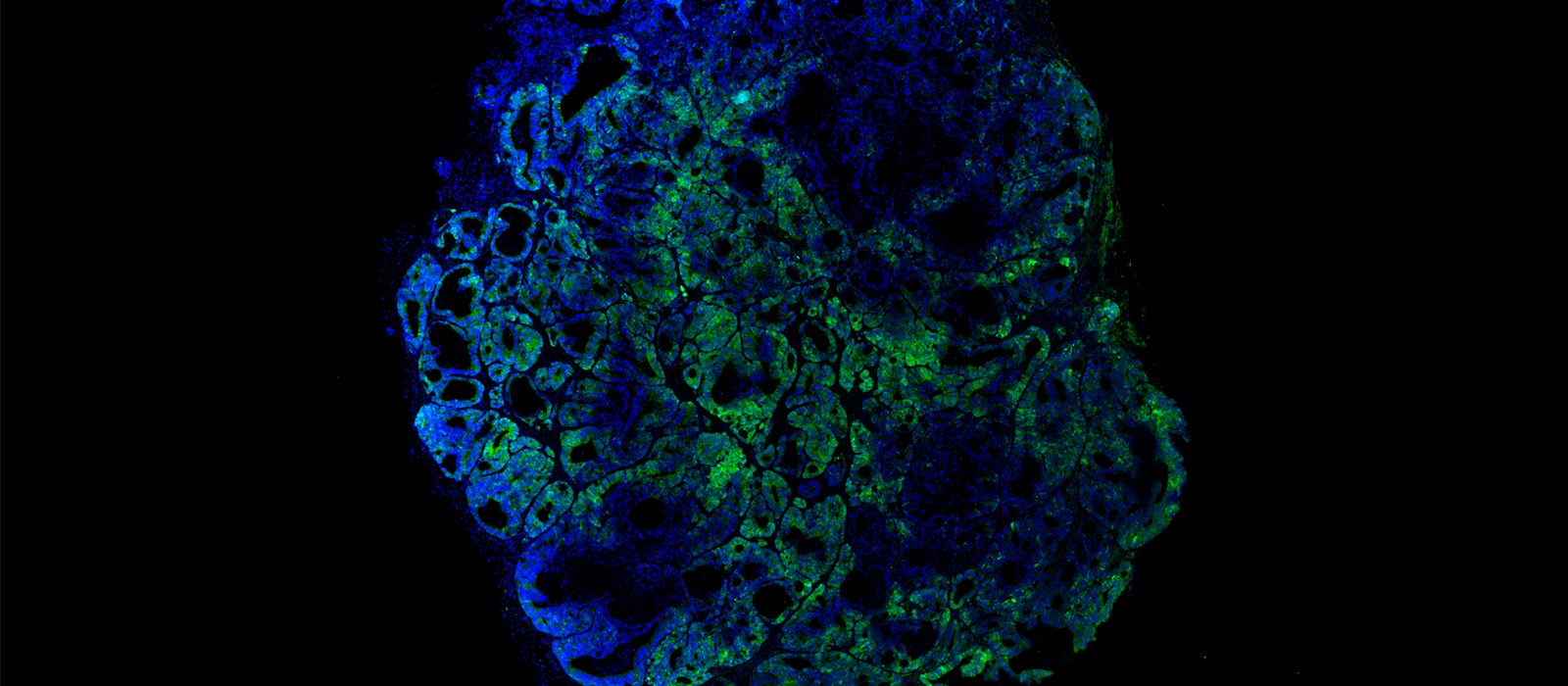 Celulas madre tumorales de colon. IRBBarcelona
