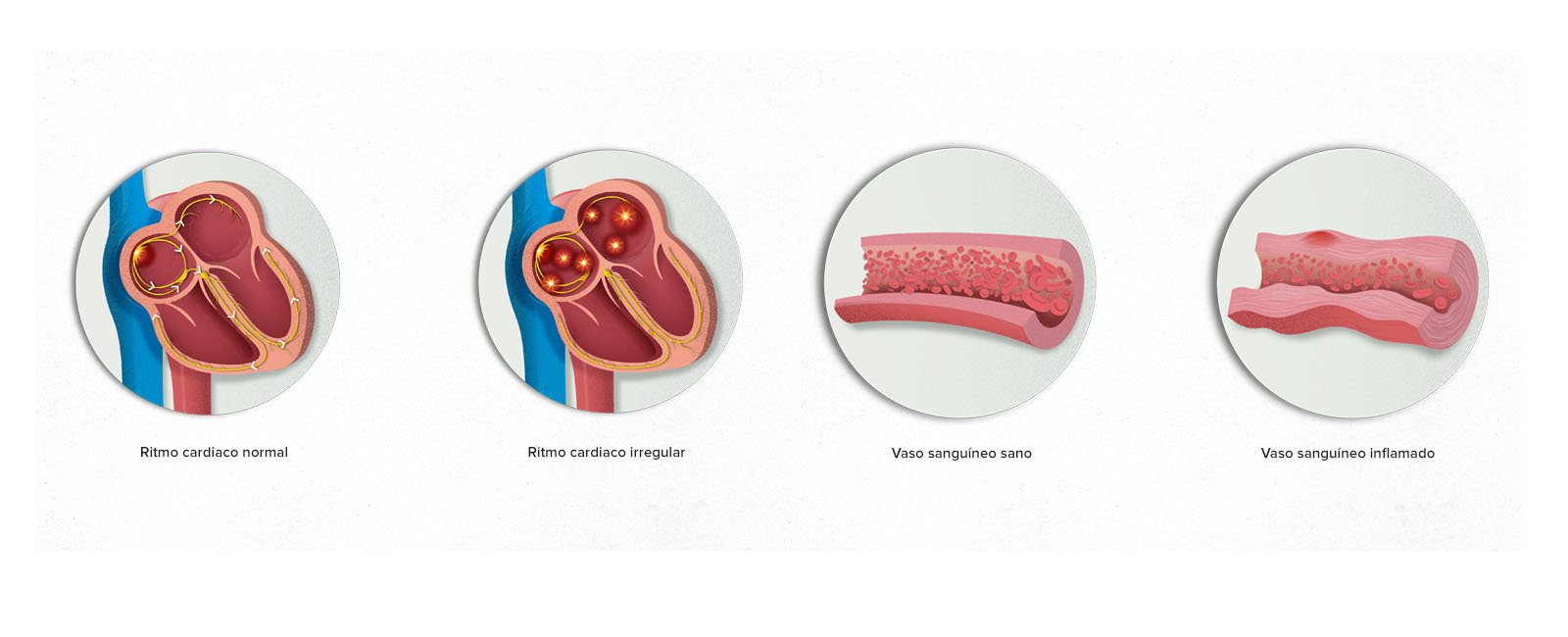 vasculitis_fibrilacion_hospital_clinic_1600x650